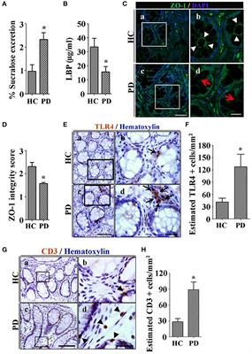 Gut-Derived Sterile Inflammation and Parkinson's Disease